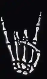  Ortopedia  Radiografía De Mano Rock