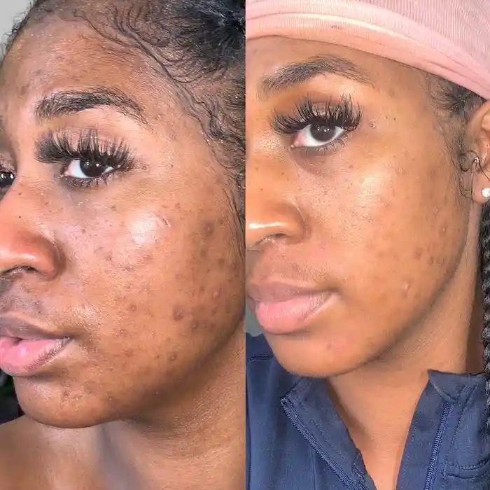 Aceite corrector  Volition