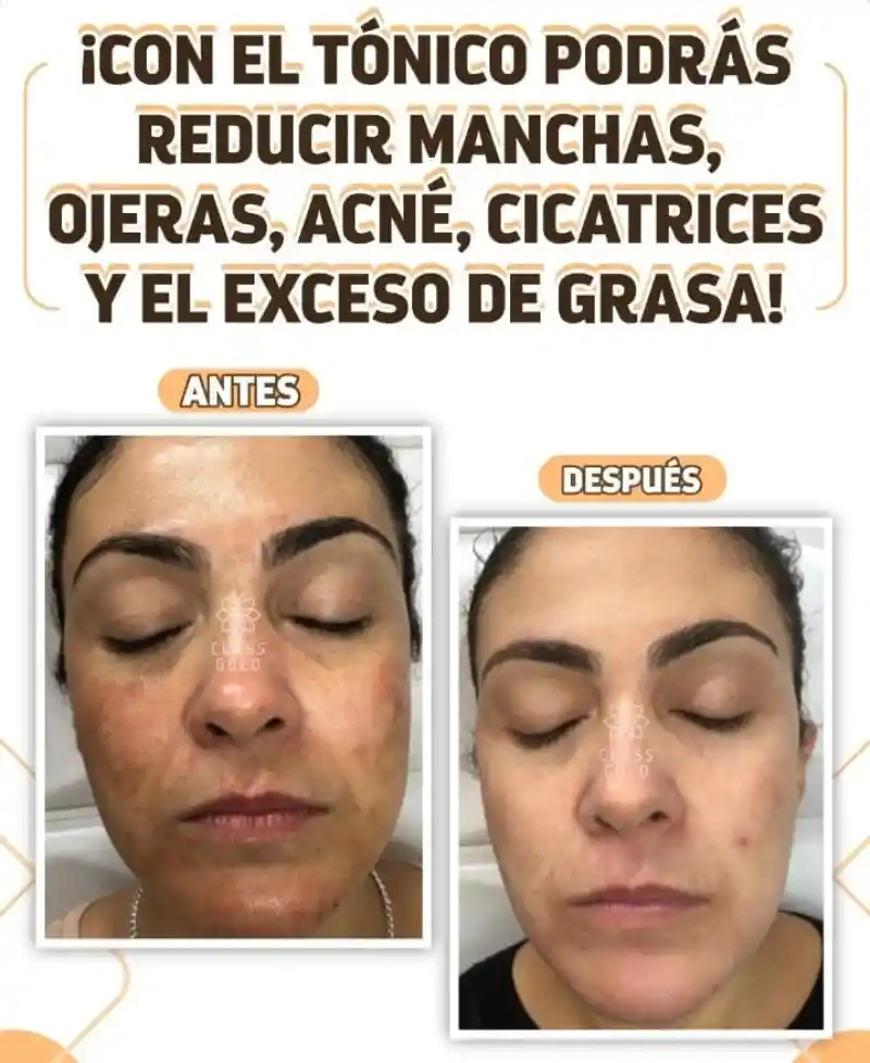 CLASS GOLD Kit Antimanchas Facial