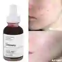 THE ORDINARY Aha 30% + Bha 2% Peeling Solution -