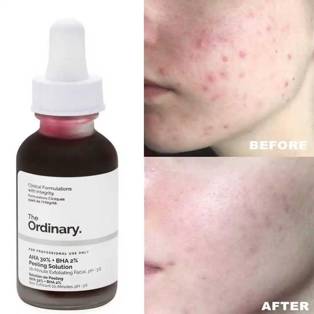 THE ORDINARY Aha 30% + Bha 2% Peeling Solution -