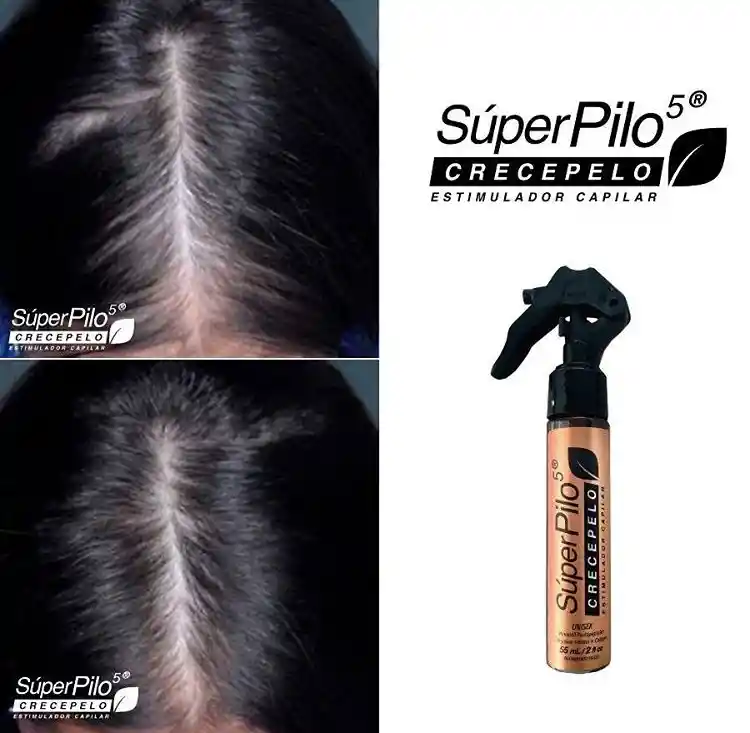 Minoxidil Superpilo Crecepelo/ Especial Para El Crecimiento Del Cabello Y La Barba/Unisex/ Con