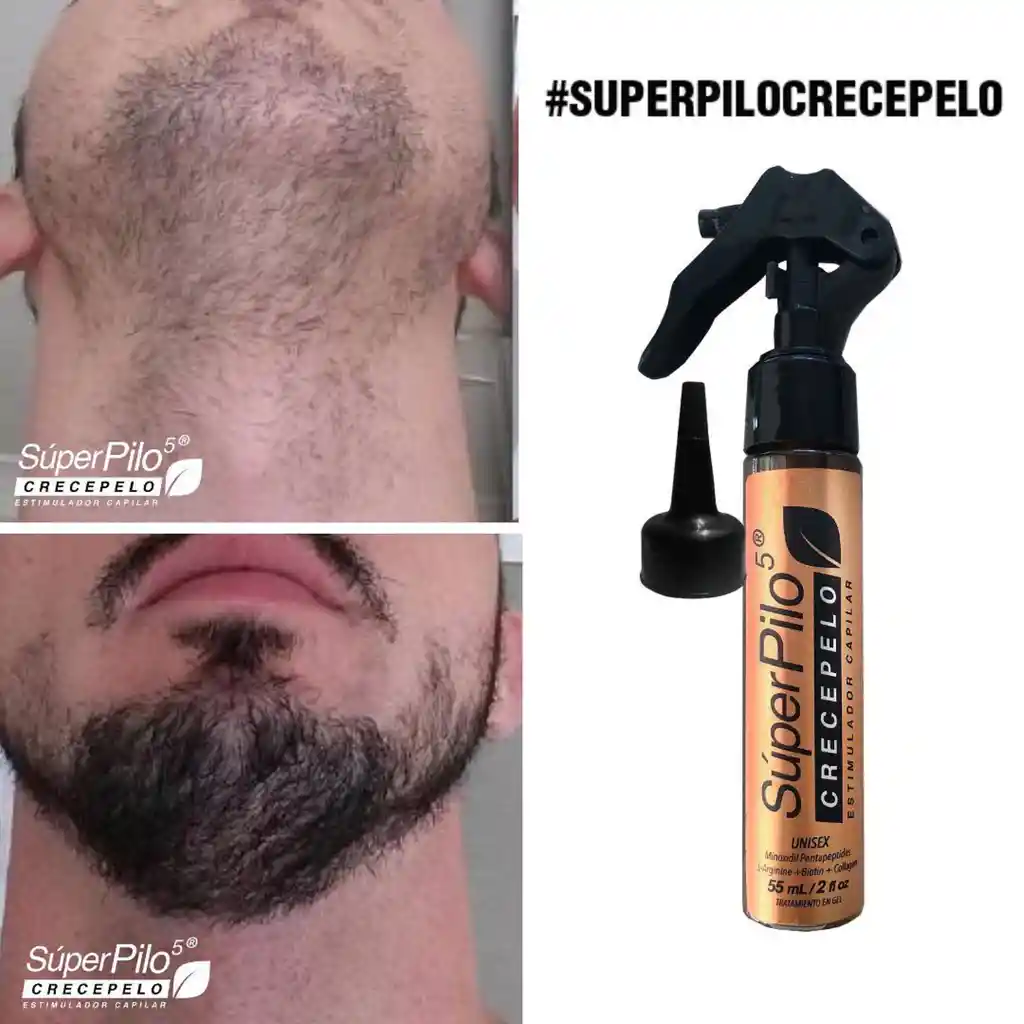 Minoxidil Superpilo Crecepelo/ Especial Para El Crecimiento Del Cabello Y La Barba/Unisex/ Con