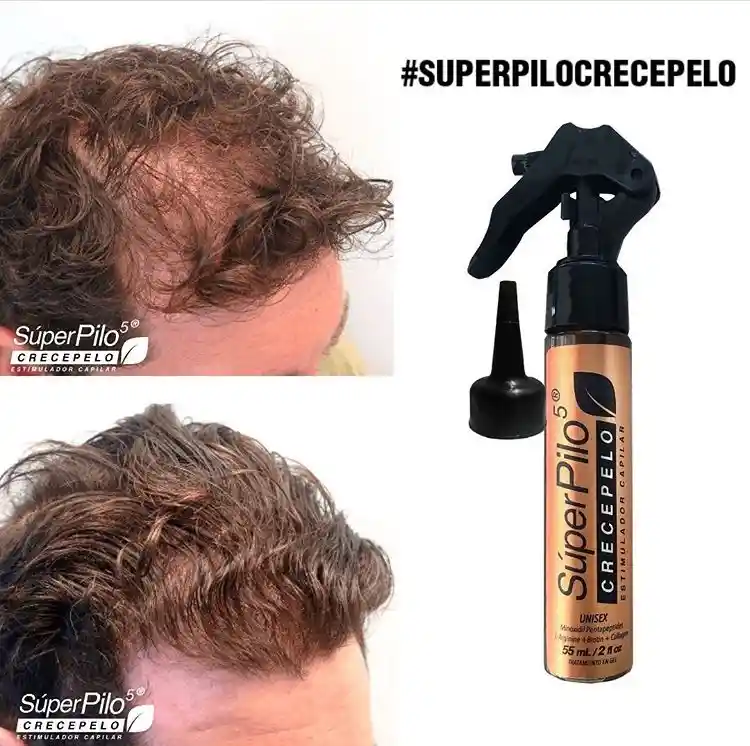 Minoxidil Superpilo Crecepelo/ Especial Para El Crecimiento Del Cabello Y La Barba/Unisex/ Con