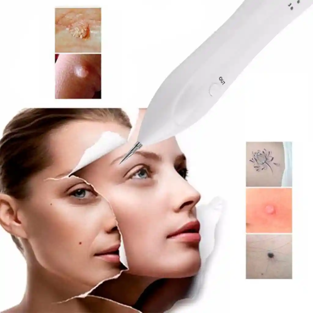 Cauterizador Digital Quita Manchas Verrugas Tatuajes Acne