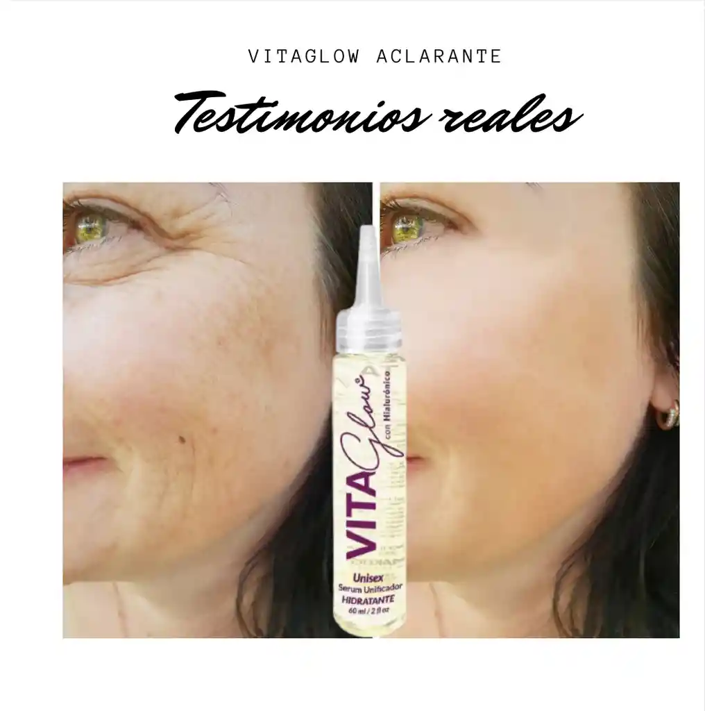 Vitaglow Aclarante Y Despigmentante Facial Y Corporal