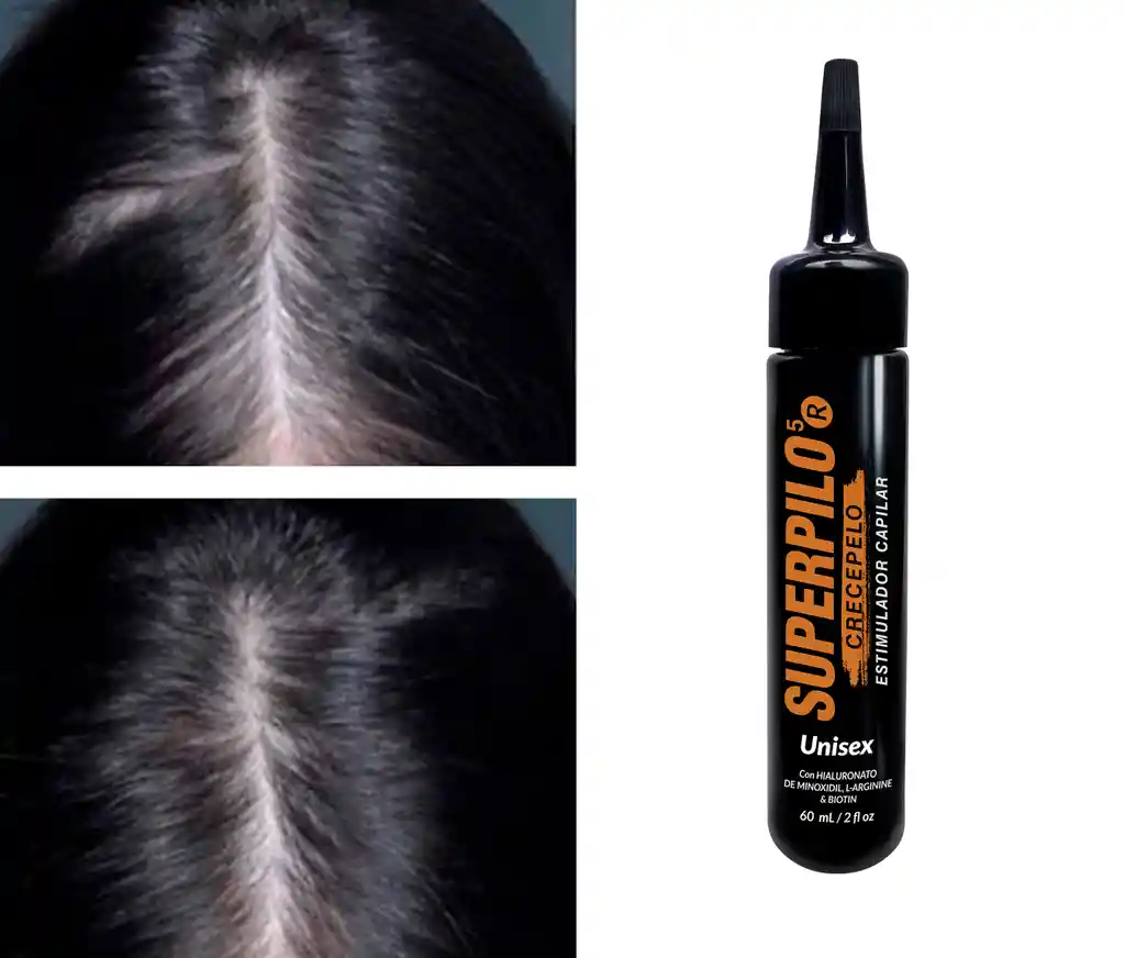 Minoxidil Superpilo Crecepelo/ Especial Para El Crecimiento Del Cabello Y La Barba/unisex/ Con