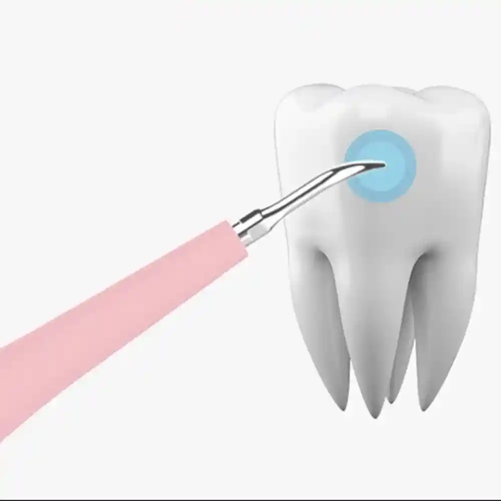 Limpiador Dental De Sarro Recargable