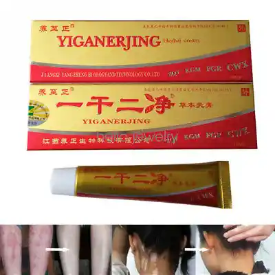 Crema China Yiganerjing Ezcema Psoriasis Piquiña Rasquiña Carranchin
