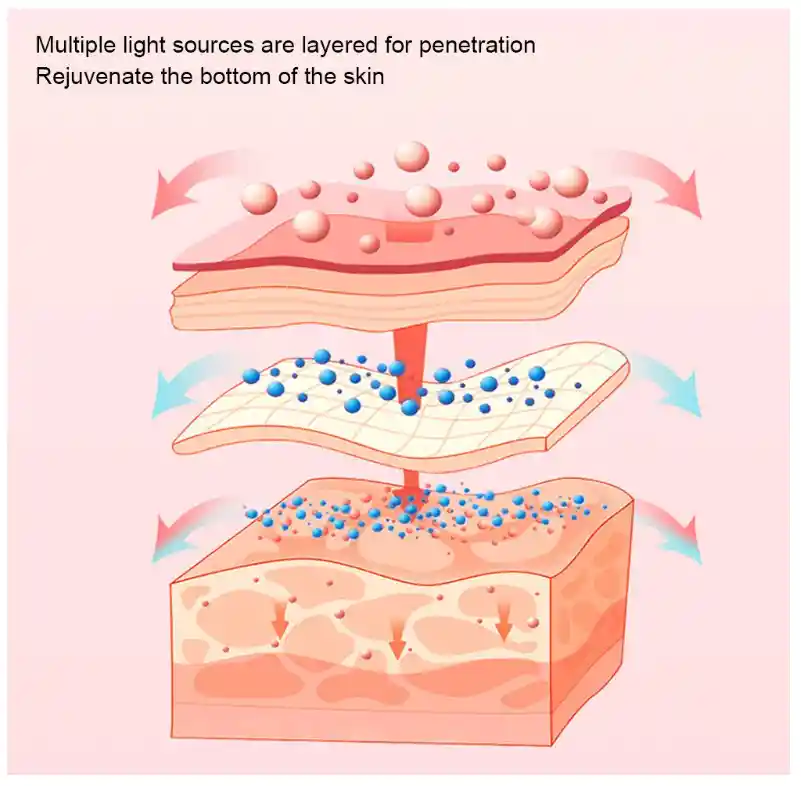 Reductor Facial Rostro Reduce Papada Y Mejilla