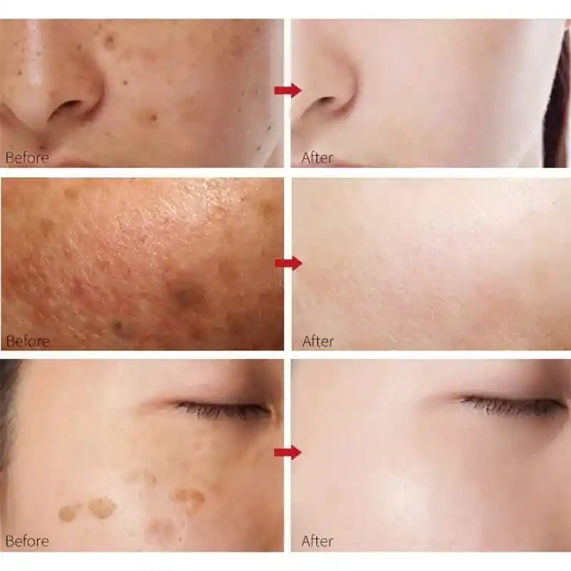 Serum Blanqueador Antiarrugas