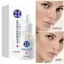 Serum Blanqueador Antiarrugas