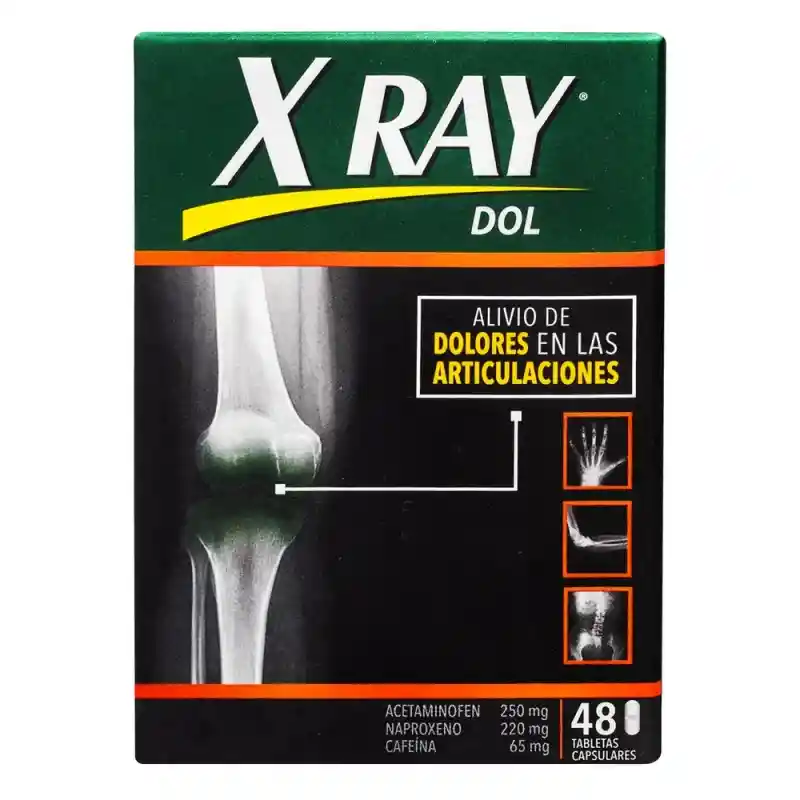 X-ray Dol Tbs