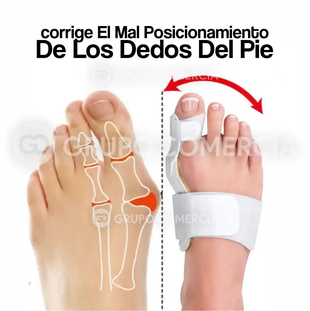 Férula Corrector De Juanete Ajustable