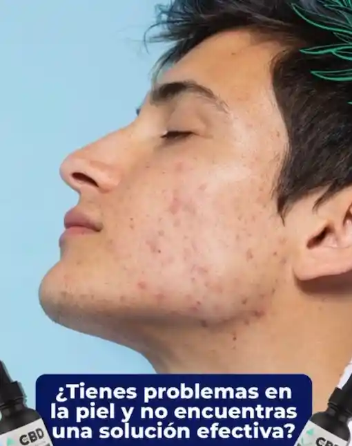 Aceite De Cbd Uso Tópico Facial