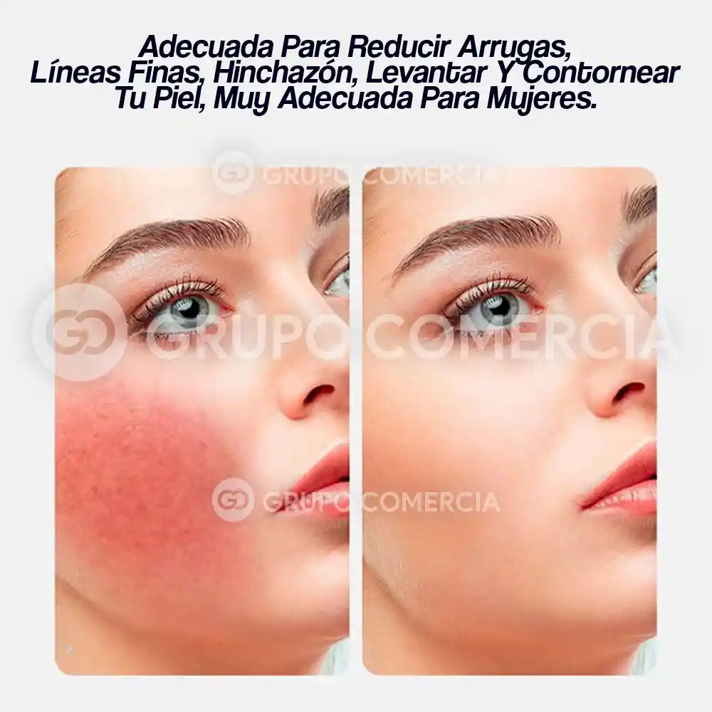 Masajeador Facial Ice Roller Anti Edad Hipoalergénico