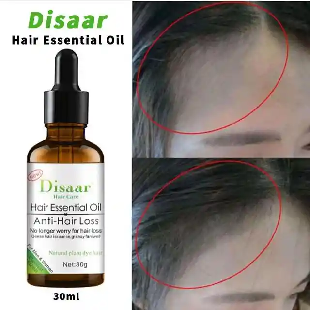 Aceite Para Caida O Perdida De Cabello