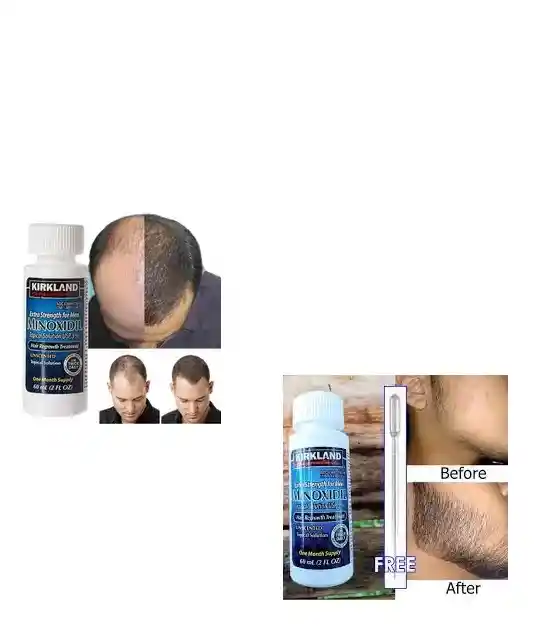 Kirkland Minoxidil 5% Extra Strength Caja X6