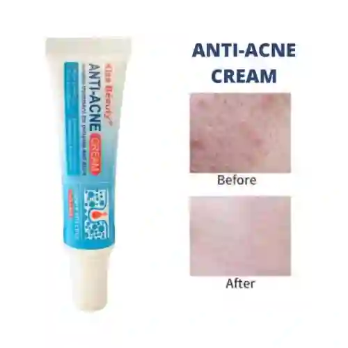 Crema Anti-acne Kiss Béauty