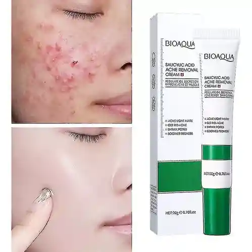 Crema Antiacné/ácido Salicílico Bioaqua Bqy49044