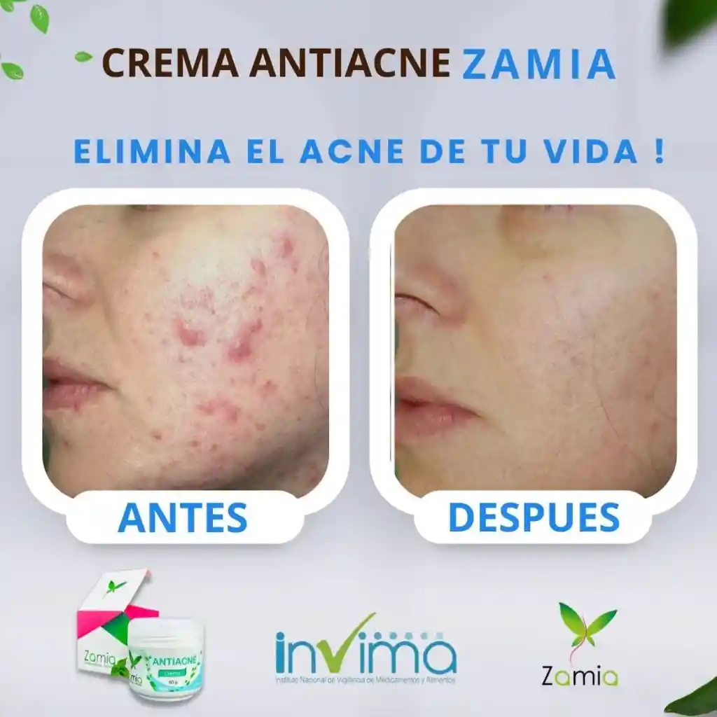 Antiacne Zamia X 2 (acido Salicílico)