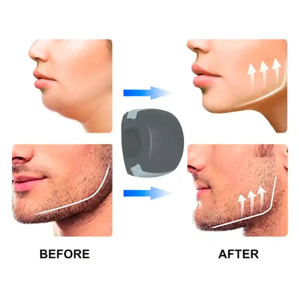 Ejercitador Mandibula Papada Tonificador Ejercicio Jawline Morado