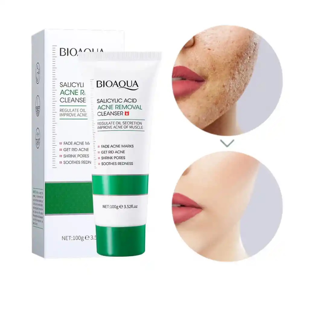 Jabon Facial Antiacné Acido Salicilico Bioaqua