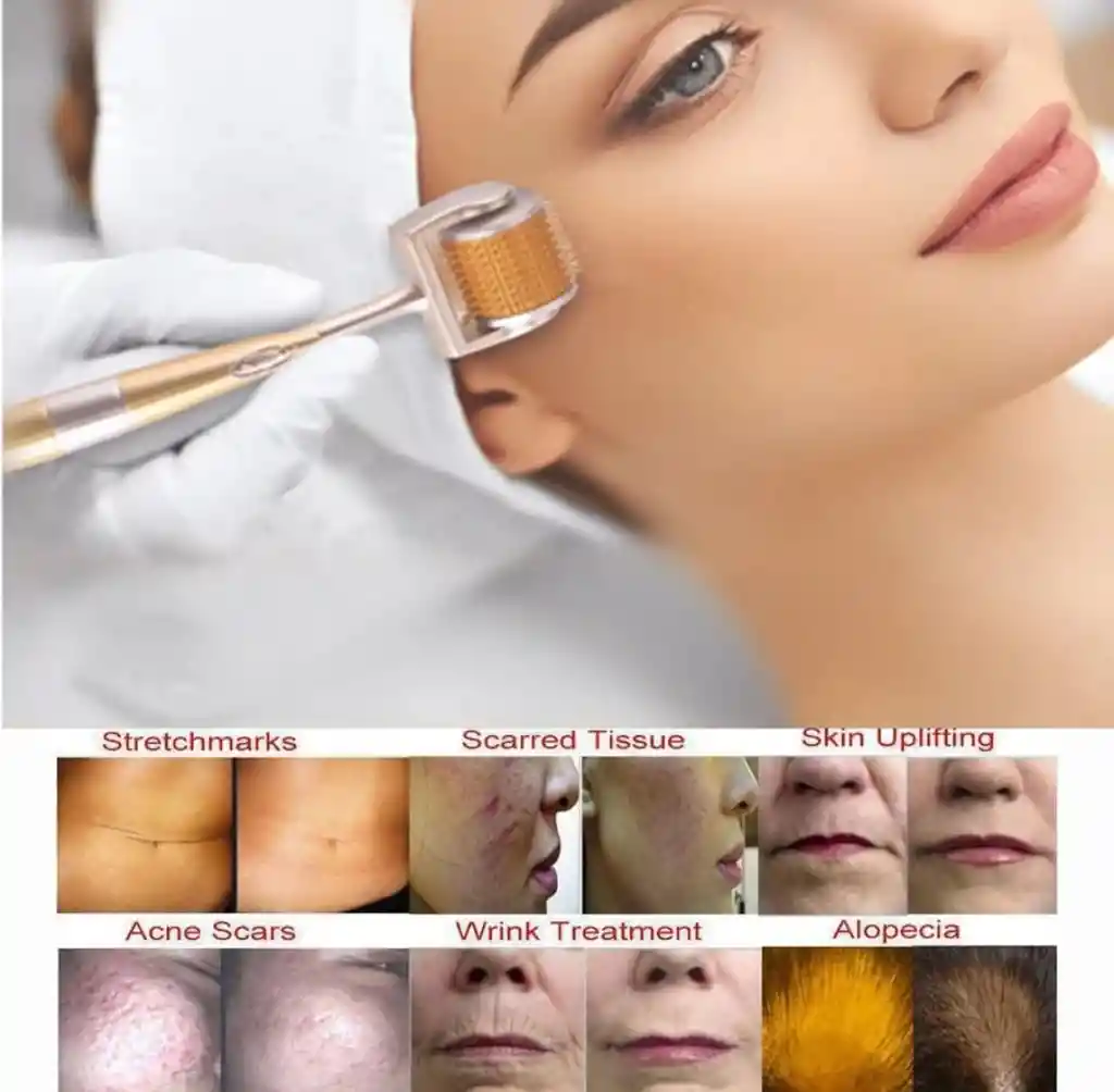 Dermarroller Agujas Titanio Derma Roller 0.50mm Rodillo
