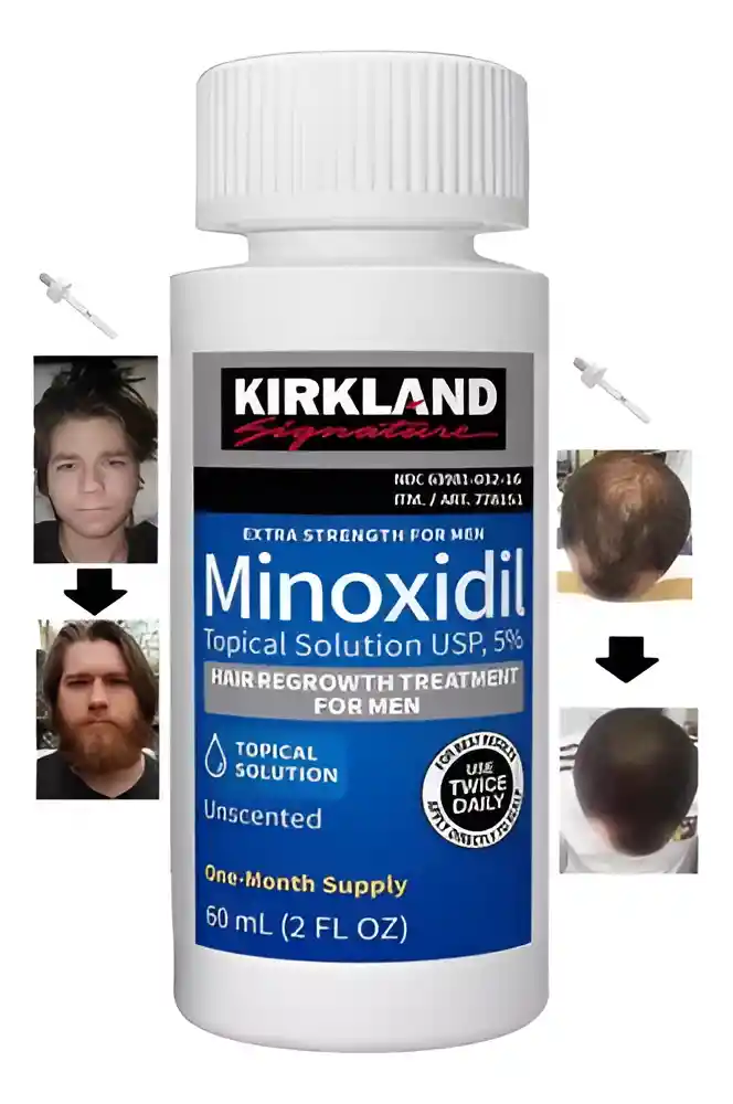 Kirkland Minoxidil Líquido 5% 60ml Tratamiento 1 Mes Sfs Mx2