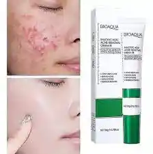 Crema Eliminadora De Acne Con Acido Salicilico 20gr Bioaqua ref 623