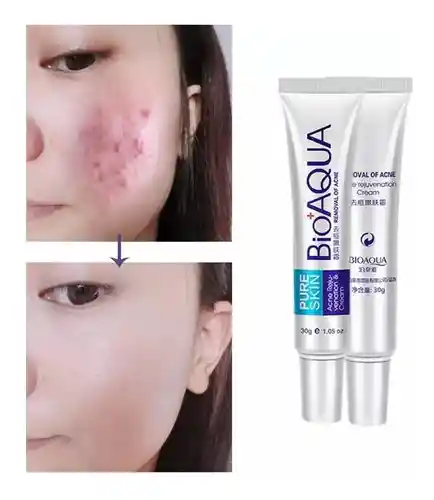 1 Crema Renovadora Anti Acne Bioaqua 30 Gr