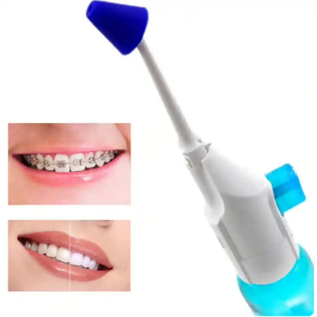 Irrigador Dental Bucal Limpieza Dental Ergonomico