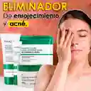 Kit Acido Salicilico X 4 Productos Promocion Hasta Agotar Existencias