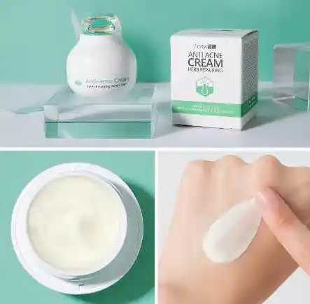 Crema Anti Acne Control Oil Reparación Elimina Manchas