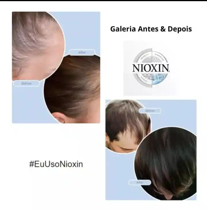 Nioxin System 4 Sh 300 Ml+caja 300 Ml+tratamiento 100 Ml Gratis