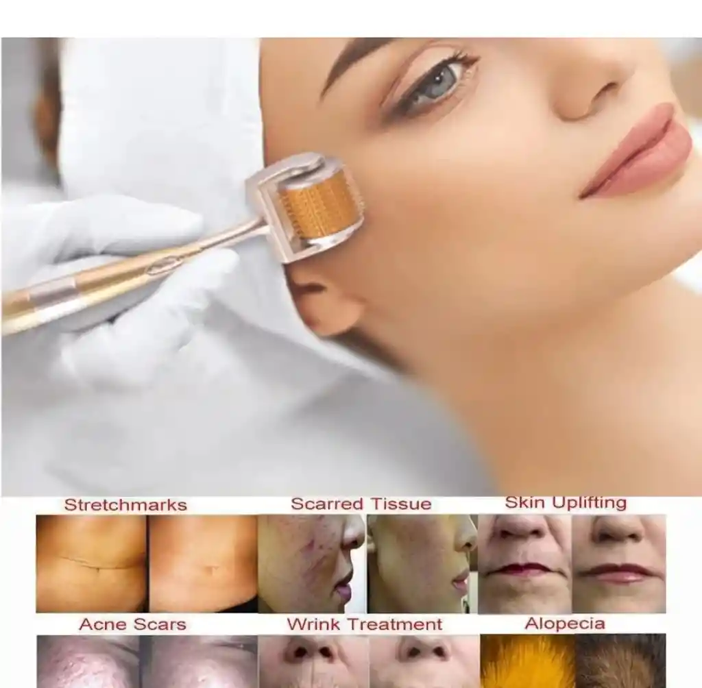Rodillo Facial Dermarroller Zgt