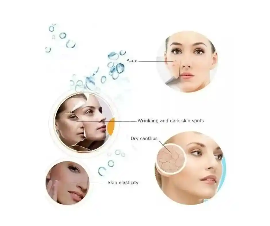 Vapor Ozono Facial Profesional