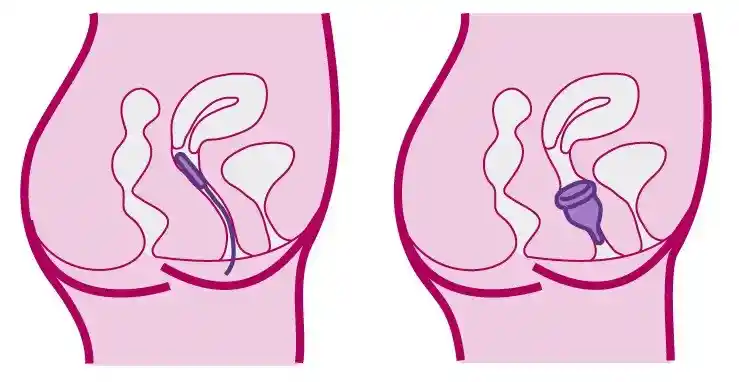 Copa Menstrual