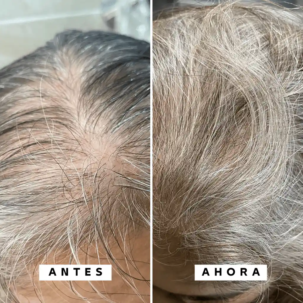 Shampoo Crecimiento Y Anticaída