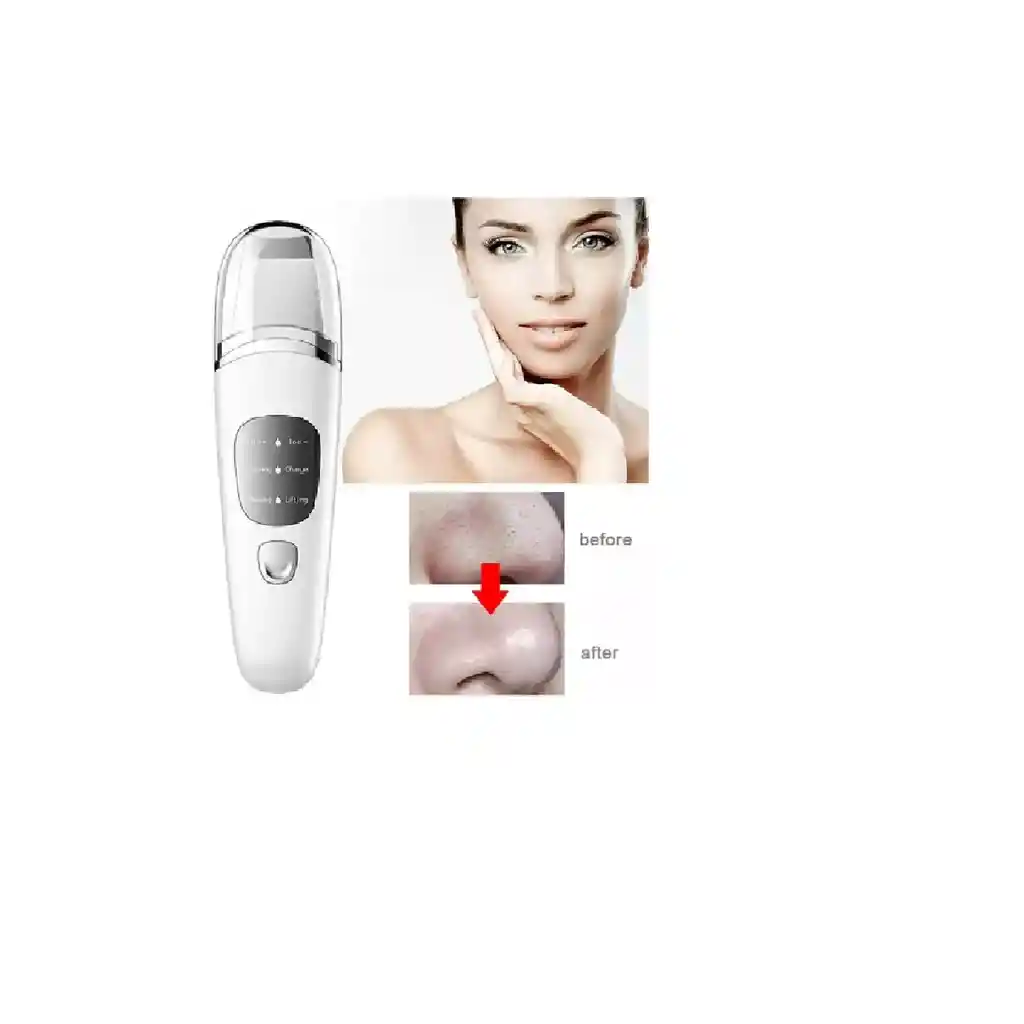 Limpiador Ultrasonido Skin Limpiador Facial