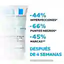 Tratamiento Facial Anti Imperfecciones La Roche Posay Effaclar Duo+ 40ml