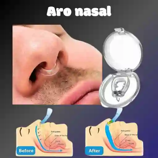 Aro Magnético No Ronquido En Silicona Dispositivo No Roncar