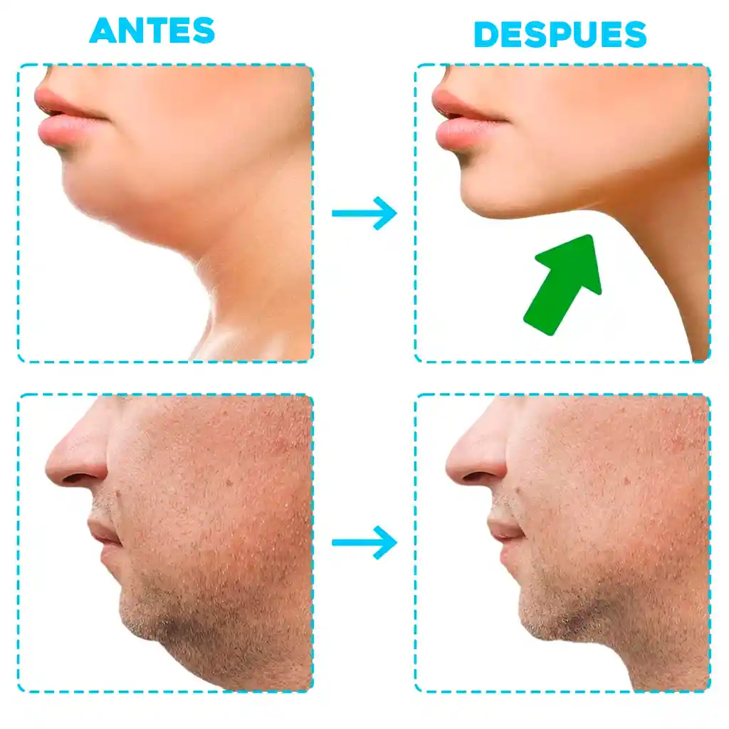 Ejercitador Mandíbula Papada Tonificador Ejercicio Jawline Negro
