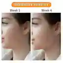 Ejercitador Mandíbula Papada Tonificador Ejercicio Jawline Negro