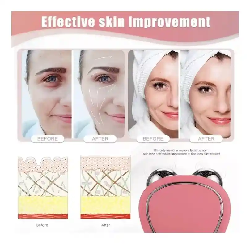 Masajeador Facial Usb Lifting Y Estiramiento Antiedad