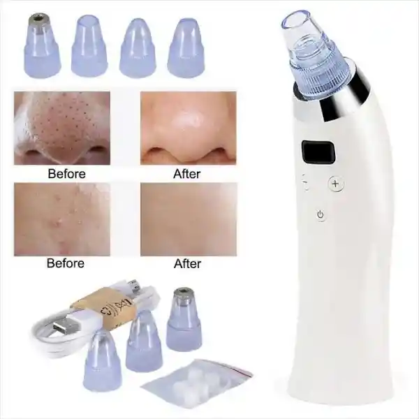 Extractor Espinilla Puntos Negros Limpiador Facial Electrico Recargable