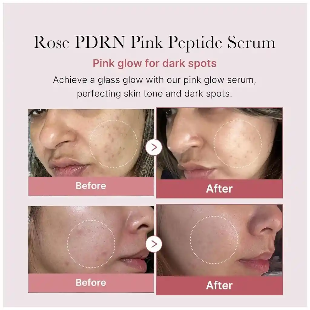 Medicube Collagen Pdrn Pink Peptide Serum 30ml