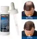 Minoxidil Kirkland