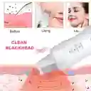 Limpiador Facial Recargable Para Exfoliacion Y Hidratacion