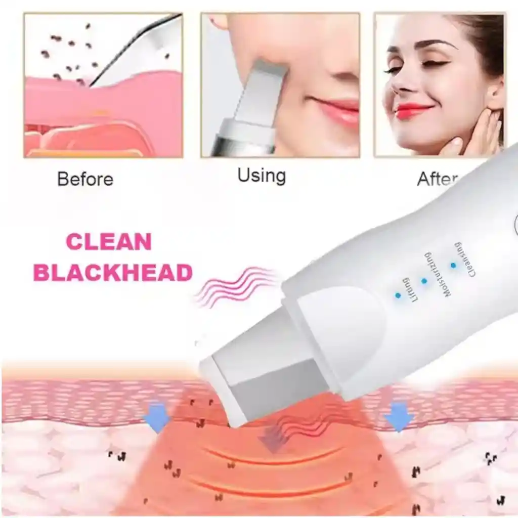Limpiador Facial Recargable Para Exfoliacion Y Hidratacion